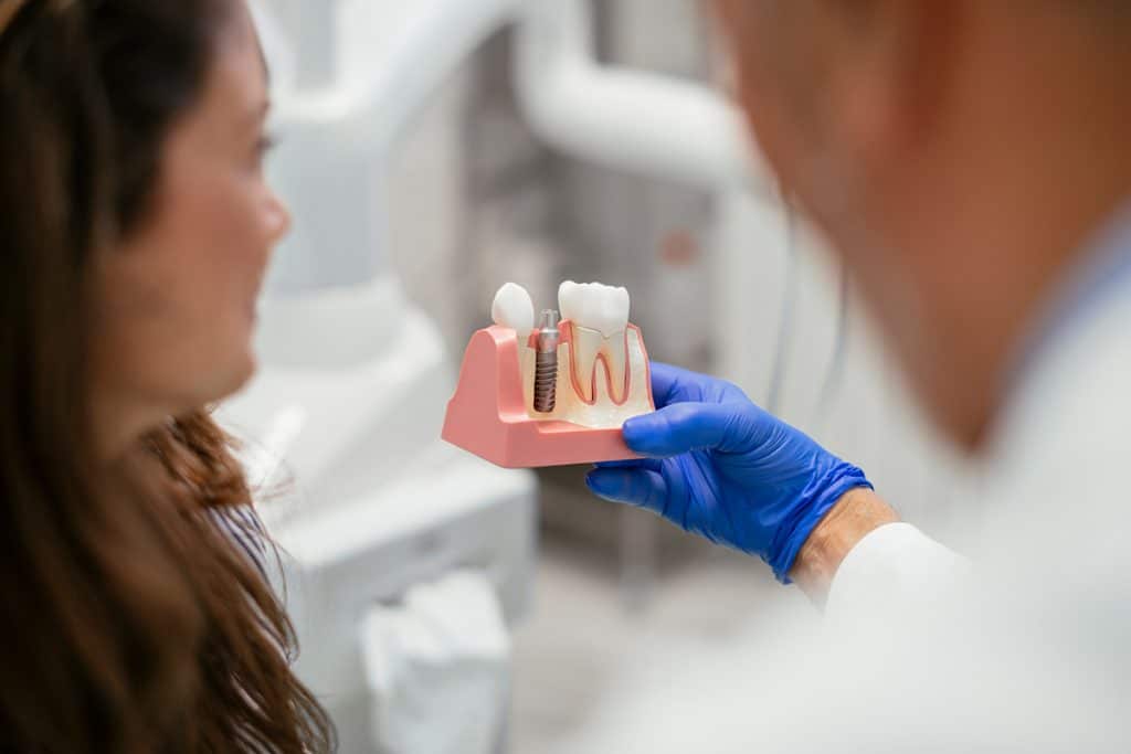 A Step by Step Guide to Dental Implants