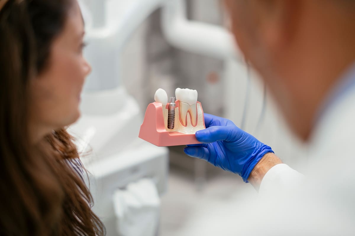 A Step by Step Guide to Dental Implants Queens Crown Dental